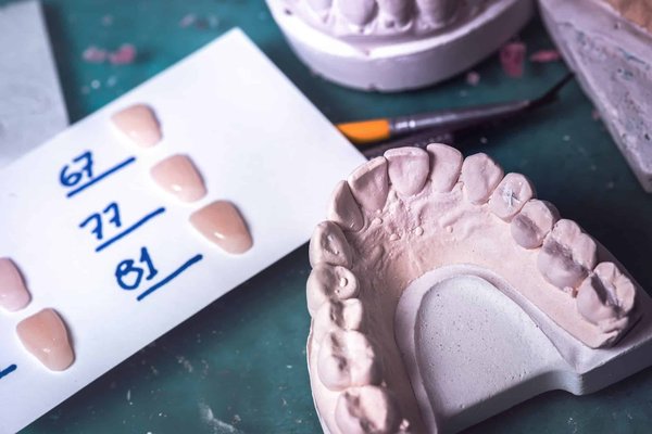 Quels types de prothèses dentaires proposez-vous à Laval ?